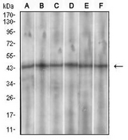 1 - Anti-SSTR3 Antibody AP96065
