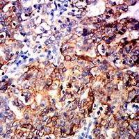 19 - Anti-TACSTD2 Antibody AP96069