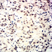 19 - Anti-TARDBP Antibody AP96070