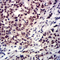 19 - Anti-TBP Antibody AP96071