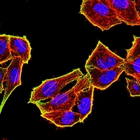 3 - Anti-TET2 Antibody AP96072