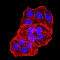 3 - Anti-AP-2-alpha Antibody AP96073