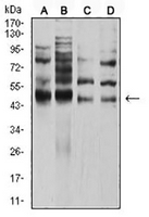 1 - Anti-AP-2-alpha Antibody AP96073