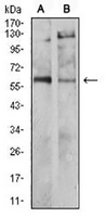 1 - Anti-Tyrosine Hydroxylase Antibody AP96076