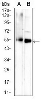 1 - Anti-CD265 Antibody AP96078
