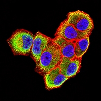 3 - Anti-CD30 Antibody AP96081