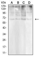 1 - Anti-CD30 Antibody AP96081