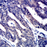 19 - Anti-CD258 Antibody AP96085