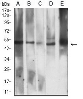 1 - Anti-CD258 Antibody AP96085