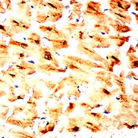 19 - Anti-cTnT Antibody AP96086