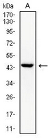 1 - Anti-cTnT Antibody AP96086