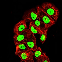 3 - Anti-Topoisomerase 1 Antibody AP96087