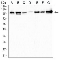 1 - Anti-Topoisomerase 1 Antibody AP96087