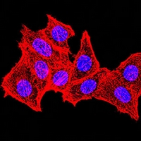 3 - Anti-Topoisomerase 2 alpha Antibody AP96088