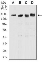 1 - Anti-Topoisomerase 2 alpha Antibody AP96088