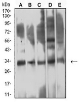 1 - Anti-CD354 Antibody AP96091