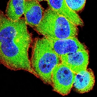 3 - Anti-TRIB2 Antibody AP96092