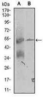 1 - Anti-TRIP6 Antibody AP96095