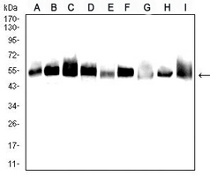 1 - Anti-Alpha-tubulin 4a Antibody AP96098