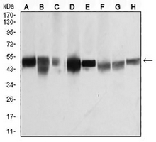 1 - Anti-Beta-tubulin Antibody AP96099