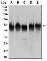 1 - Anti-Beta2A-tubulin Antibody AP96100