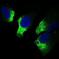 3 - Anti-TWIST Antibody AP96101