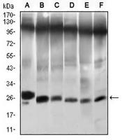 1 - Anti-TWIST Antibody AP96101