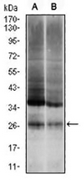 1 - Anti-UBB Antibody AP96102