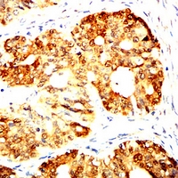 19 - Anti-PGP9.5 Antibody AP96103