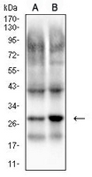 1 - Anti-PGP9.5 Antibody AP96103