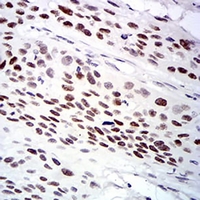 19 - Anti-UFD1L Antibody AP96104