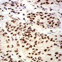19 - Anti-UHRF1 Antibody AP96105