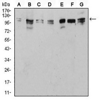1 - Anti-ULK2 Antibody AP96106