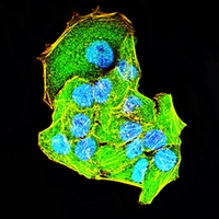 3 - Anti-ULK3 Antibody AP96107
