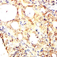 19 - Anti-ULK3 Antibody AP96107