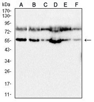1 - Anti-ULK3 Antibody AP96107