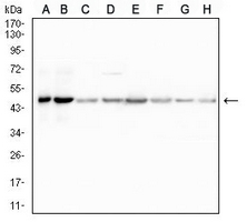 1 - Anti-UQCRC1 Antibody AP96108