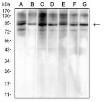 1 - Anti-VCP Antibody AP96115