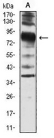 1 - Anti-Villin Antibody AP96117