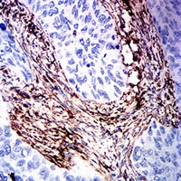 19 - Anti-Vimentin Antibody AP96118
