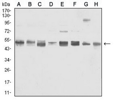 1 - Anti-Vimentin Antibody AP96118