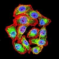 3 - Anti-Wilms Tumor 1 Antibody AP96119