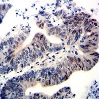 19 - Anti-Wilms Tumor 1 Antibody AP96119