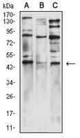 1 - Anti-Wilms Tumor 1 Antibody AP96119