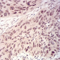 19 - Anti-WTAP Antibody AP96120