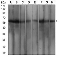 1 - Anti-WTAP Antibody AP96120