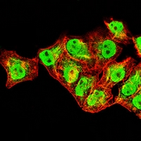 3 - Anti-XPC Antibody AP96121
