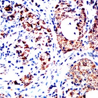 19 - Anti-XPC Antibody AP96121