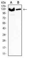 1 - Anti-XPC Antibody AP96121