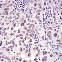 19 - Anti-Ku70 Antibody AP96123